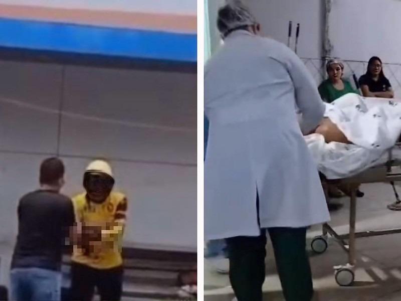 Mototaxista tem mão amputada após golpe com facão durante briga